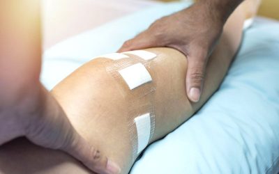 Persistent knee pain and stiffness after injury or surgery