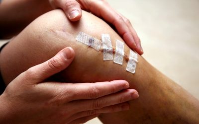 ACL reconstruction is not for all — A need for improved patient selection