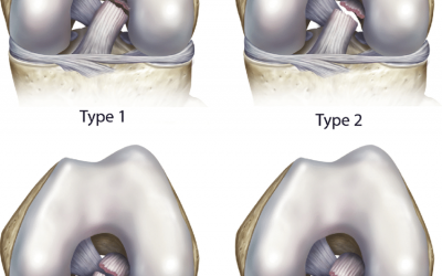 Higher burden of ACL and hamstring injuries in Asian footballers