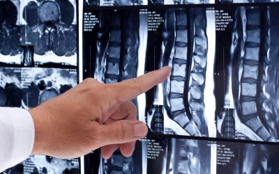 How imaging can affect pain and disability?
